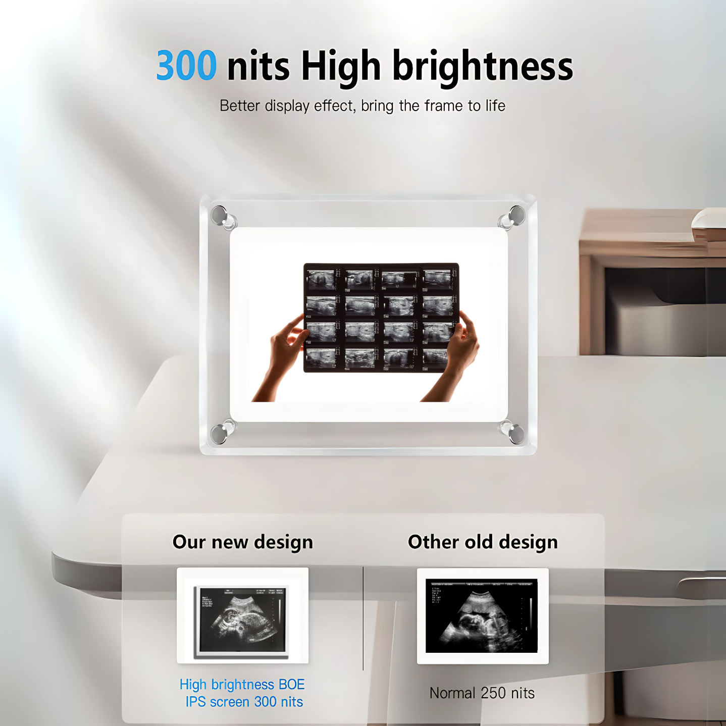 ChiccoFrame™ Custom Baby Ultrasound Digital Photo Frame