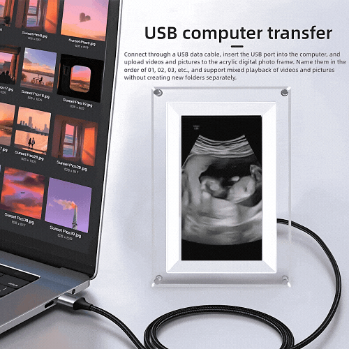 ChiccoFrame™ Custom Baby Ultrasound Digital Photo Frame